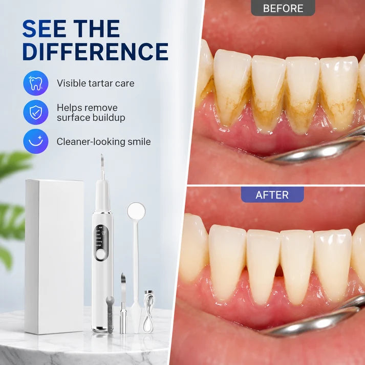 Portable Ultrasonic Teeth Cleaning Set