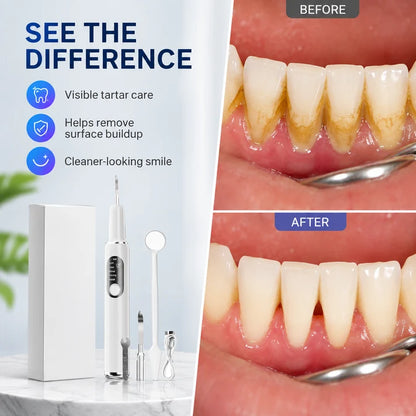 Portable Ultrasonic Teeth Cleaning Set