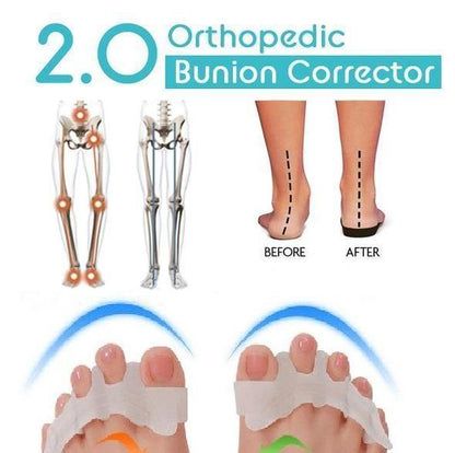 Orthopedic Bunion Corrector 2.0 (1 PAIR)